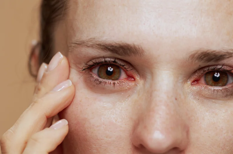 Air Pollution and Eye Irritation: Exploring the Link and Solution